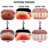ELYMONT מנקה שיניים חשמלי